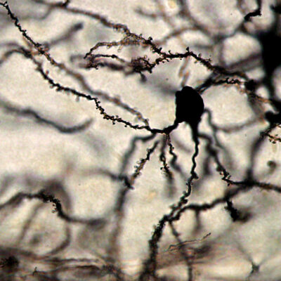 Circuitos cerebrales: La neurona al detalle