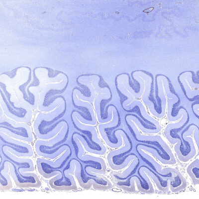 Brain seaweeds